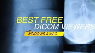 Best DICOM Viewers [upl. by Lagiba]