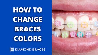 How to Change Braces Colors [upl. by Freya858]