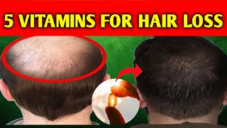 5 POWERFUL Vitamins That Prevent Hair LossDo Vitamins Actually Prevent Hair Loss [upl. by Ledarf]