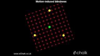 Motioninduced blindness test for the severity of ADHD  eChalk illusion [upl. by Harutak]