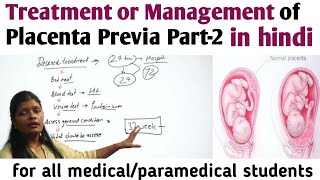 Management or treatment of Placenta Previa Part2  प्लेसेंटा प्रेविया में डिलीवरी नार्मल या ऑपरेशन [upl. by Tjaden840]