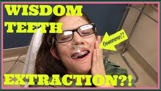 WISDOM TEETH EXTRACTION ROAD TO RECOVERY  28 MONTHS UPDATE [upl. by Jewett674]