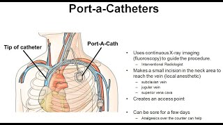 24 Principles of Port A Cath Placement amp Management [upl. by Asseral]