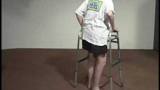 Abnormal Gait Exam  Neuropathic Gait [upl. by Maurita586]