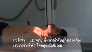 Cervical Vertebrae  Anteroposterior ProjectionOttonello Method [upl. by Eelarbed]