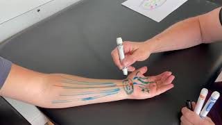 Carpal Tunnel Syndrome Anatomy and How To Treat It CTS [upl. by Arleen]