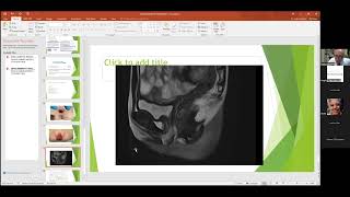 oct 2024 pleural effusion  accreta extramniotic pregnancy  andominal pregnancy best of isuog [upl. by Louisa887]