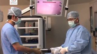 Basics of Robotic Surgery Da Vinci Si HD Surgical System Instructional Video [upl. by Knapp]