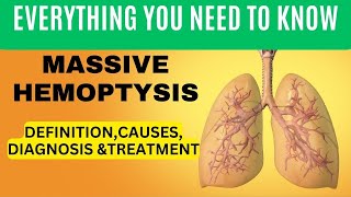 Massive Hemoptysis Lifethreatening Hemoptysis Definition Causes Diagnosis and Management  11 [upl. by Doe]