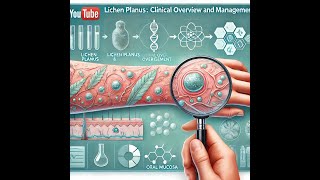 Lichen Planus Clinical Overview and Management [upl. by Havstad]