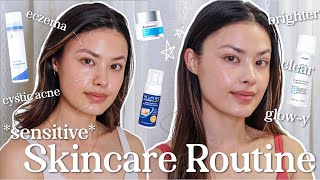 My BEST Skincare Routine for Sensitive Skin Cystic Acne amp Eczema [upl. by Lloyd]