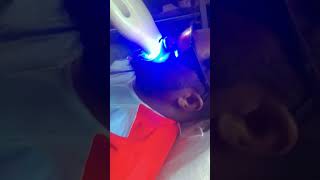 Teeth whitening 🤭viralvideo video viralshorts viral [upl. by Gabey909]