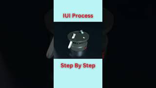 Revealing the Ultimate IUI Process infertility pregnancy doctor [upl. by Rowland]