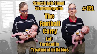 12L Stretch Shortened Left Side with the Football Carry LeftSided Torticollis Treatment in Babies [upl. by Leunammi153]