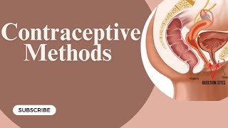 Contraceptive methods  Gynaecology Lecture  Part 11 [upl. by Eslek]