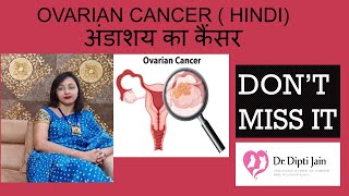 OVARIAN CANCER  HINDI अंडाशय का कैंसर DONT MISS IT [upl. by Epilef44]