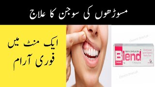 Masoro ki Sujan ka ilaj  Gum Swelling Treatment in Urdu amp Hindi [upl. by Ralyks]