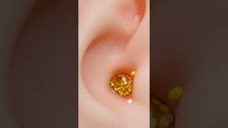 Removing earwax earwaxremoval earcleaning [upl. by Niowtna894]