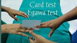 Card testEgawa testulnar nerve palsyclaw hand [upl. by Aerdnaed]