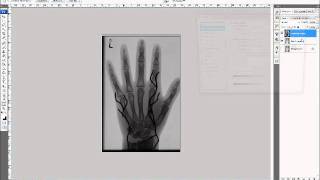 Subtraction Imaging Explained [upl. by Leseil]