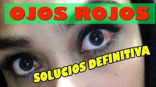 Como quitar los ojos rojos rapido casero [upl. by Seuqcaj]