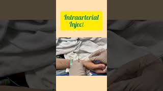 Types of Injection IV  IM  SC  INTRADERMAL INTRA ARTERIAL INTRATHECAL  INTRA ARTICULAR [upl. by Caz834]