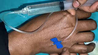 Intravenous injection video Iv ceftriaxone Omeprazole Ketorolac injection push 24 ep99 [upl. by Drugi570]