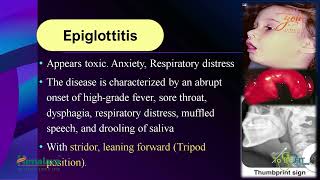 Clinical Approach For Stridor amp Wheezing In Pediatric  Dr Rafat Alkadi [upl. by Holly]