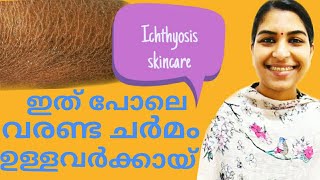 Ichthyosis Skin Care Malayalam  Sini Thomas [upl. by Mackey]