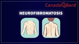 Neurofibromatosis [upl. by Iz]