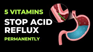 Top 5 Vitamins To Stop Acid Reflux Permanently  Acid Reflux  INTAI [upl. by Alleahcim]