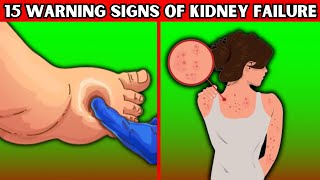 15 warning Signs That Shows Your Kidney Failure Kidney Failures Early Symptoms [upl. by Eniamert]