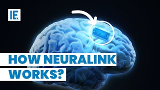 Elon Musk’s Neuralink gets FDA Approval See How It Works [upl. by Stryker]