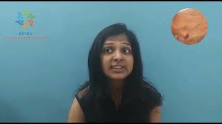 Symptoms of NF1 vs NF2 by Dr Pranshi Agrawal [upl. by Akcirehs]