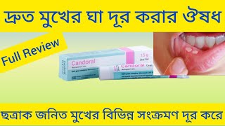 Candoral Oral Gel Miconazoleমুখের ঘা এবং ছত্রাক জনিত বিভিন্ন সংক্রমণ দূর করার ঔষধ সম্পর্কে আলোচনা [upl. by Dyl]