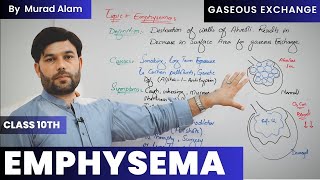 Emphysema Respiratory Disorder l Biology 10th in UrduHindi l Ch Gaseous Exchange [upl. by Aicenad866]