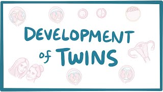 Development of twins [upl. by Dimah267]