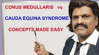 CONUS MEDULLARIS vs CAUDA EQUINA SYNDROME CONCEPTS MADE EASY [upl. by Mindi]