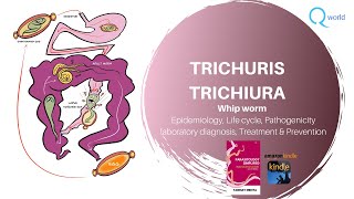 Trichuris trichiura Parasitology simplified tutorials For NEXT USMLE NEET PG PLAB [upl. by Ikcim]