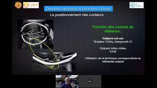 BIOMÉTRIE FOETALE BIEN MESURER  ÉCHOGRAPHIE OBSTÉTRICALE [upl. by Sadie]