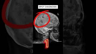 X ray quiz 37 nursing nursingstudent doctor USMLE MBBS hospital anatomy ctscan radiology [upl. by Fradin]