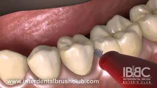 HOW TO USE AN INTERDENTAL BRUSH [upl. by Engle108]