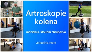 Artroskopie kolena  videodokument  průvodce po ošetření menisků a kloubní chrupavky [upl. by Noj]