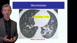 ECN PID cours 1 DFASM1 Diagnostic des PID Pr V Cottin Lyon [upl. by Asli]