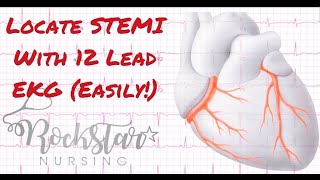 Locate and interpret STEMI based on 12 Lead EKG [upl. by Aiuqet]