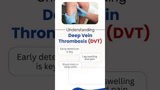 Deep Vein Thrombosis DVT  Deep Vein Thrombosis Treatment  Dr Nikhil Bansal  Jaipur [upl. by Airrat]