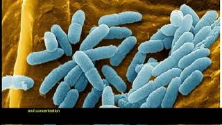 An Experimental Design of LAsparaginase Excreted by Pseudomonas aeruginosa Isolated from Poincianel [upl. by Goldia]