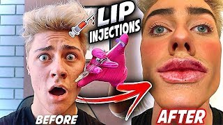 GETTING LIP INJECTIONS TO SEE HOW BIG MY LIPS CAN GET [upl. by Meneau]