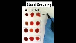 Blood Grouping made easy [upl. by Symer]