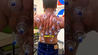 This is an extremely strange procedure 😲viral satisfying weird shorts [upl. by Mas]